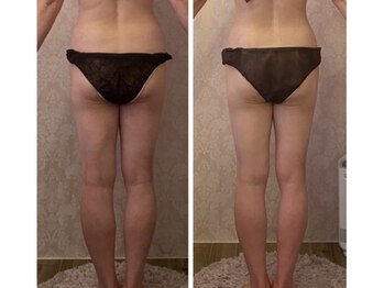 ルポーゼ(Repose)/