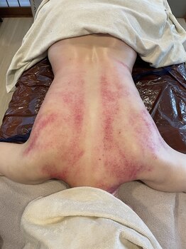 エクセレントビューティーサロン 艶(EN)の写真/頑固な凝り・首や肩のつらさを改善へ！筋膜・骨格バランス調整◎血流と巡りを整えリフレッシュ♪