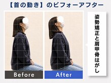 ウェルメディカル 豊中駅前整体院/整体×姿勢矯正【肩こり/腰痛】