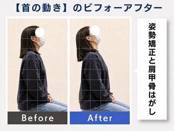 ウェルメディカル 豊中駅前整体院/整体×姿勢矯正【肩こり/腰痛】