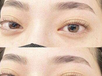 トイロ(Toiro)/ハリウッドブロウリフト