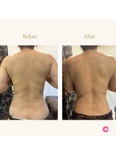 エードット 銀座(A.)/before　→　after