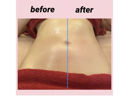 ミューゼルビューティー(MUSELLE BEAUTY)の写真