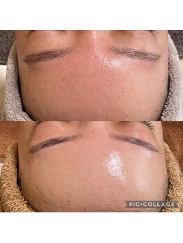 ラクシュミー ナチュラル(Laksmy NATURAL)/お客様Before after