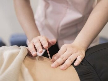 名古屋ハピネス鍼灸接骨院丸の内の写真/【首、肩、腰の辛い痛みに】筋肉にダイレクトにアプローチするので痛みを緩和☆鍼灸施術が初めての方にも◎