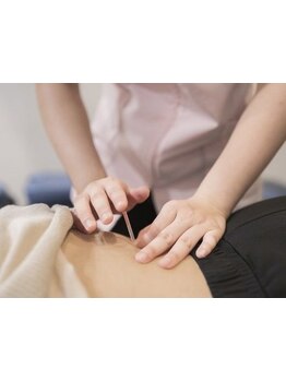 鍼灸施術を受けたい