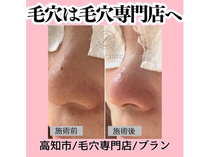 ブラン(blanc)の写真