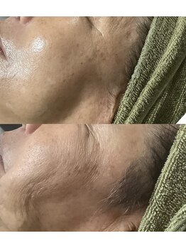 サザンベル 石垣店(SOUTHERN BELLE)/リアボーテACトリートメント