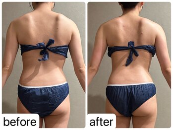 メロウ(me: llow)/恵比寿/痩身エステ