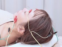 神戸はりのわ鍼灸院の雰囲気（違う！最新の進化系美容鍼！新感覚の電気美容鍼。）