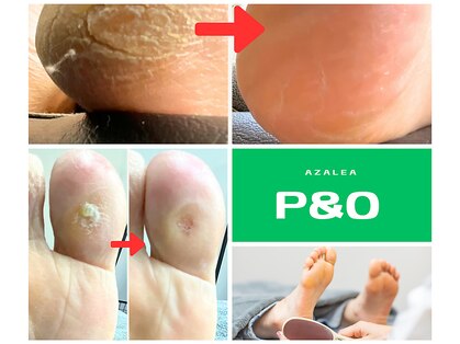 ピーアンドオーつつじ(P&Oつつじ)の写真