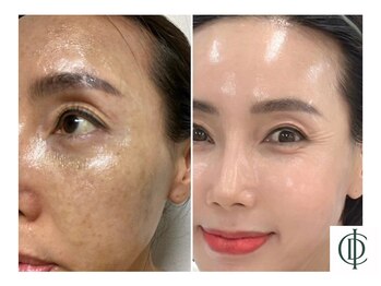 ベラ 東京院(Bella)/インセルダム-ICD-韓国最新美容