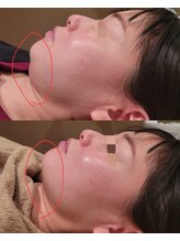 サロン ソワイユ(salon soyeux)/話題のREDショット☆