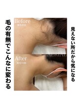 エアリアル 筑紫野店/自分じゃ見えないからこそ！