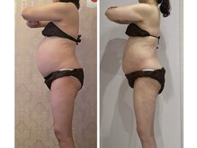 ルポーゼ(Repose)/