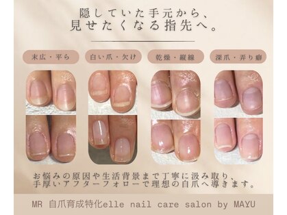 エムアール(MR)の写真