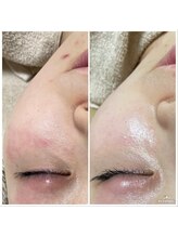 クレイエ(KREIE)/陶器のような艶肌に導きます！