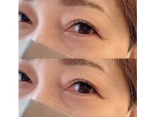 エムズサロン(M.s salon)/フラットラッシュ付け放題