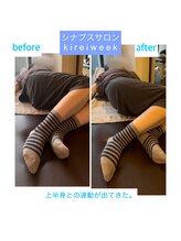 きれいウィーク 恵比寿/股関節周り施術before、after