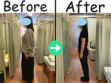 杉本接骨鍼灸院/【ダイエット】34歳 　18.2kg