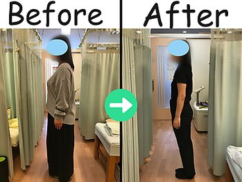 杉本接骨鍼灸院/【ダイエット】34歳 　18.2kg