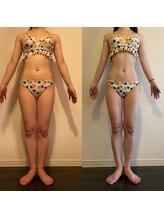 レナトゥス 銀座(Renatus)/BeforeAfter【痩身/東京/銀座】