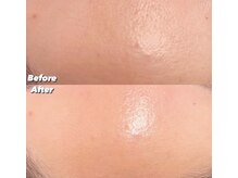 リンダ 西宮店(LINDA)/プラズマシャワー