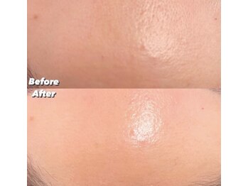 リンダ 西宮店(LINDA)/プラズマシャワー