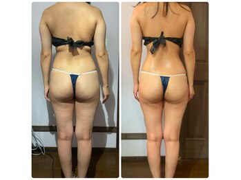 ラビーバ(Ravviva)