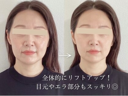 希実鍼灸院(nozomi)の写真