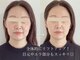 希実鍼灸院(nozomi)の写真