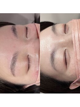 シャルコット(shall cocotte。)/ハリウッドブロウリフト