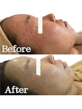 エクレ(eclat)/ララピール×ララショット