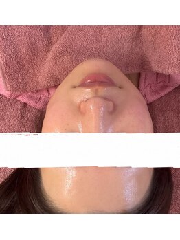 ソフィア(Sophia)/セラピール