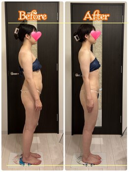 トータルボディセラピーハート(Heart)の写真/【痩せ姿勢×バストUP→女性らしいメリハリBODYが叶う】お腹ポッコリ/背中・脇肉/ヒップUP/くびれを全部GET