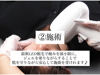 シャイン(SHINE)/2 施術