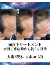 メンズサロンアール(AR)/プロセルセラピーズ