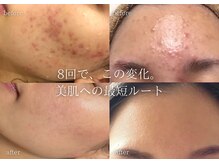 リアルナ(REALUNA)