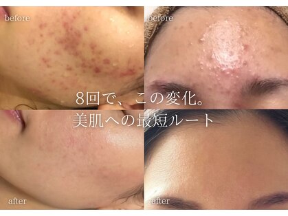 リアルナ(REALUNA)の写真