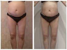 ルポーゼ(Repose)/