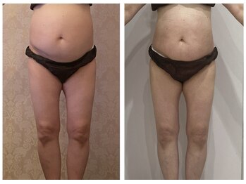 ルポーゼ(Repose)/