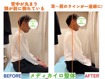 四条大宮アシスト鍼灸整骨院/全身整体ビフォーアフター