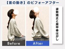 ウェルメディカル 豊中駅前整体院/整体×姿勢矯正【肩こり/腰痛】