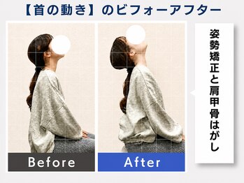 ウェルメディカル 豊中駅前整体院/整体×姿勢矯正【肩こり/腰痛】