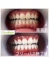 ルブラン 奈良店(Le Blanc)/ホワイトニングも美容の1つ！