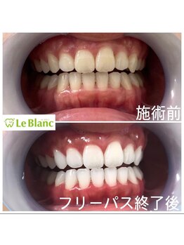 ルブラン 奈良店(Le Blanc)/ホワイトニングも美容の1つ！