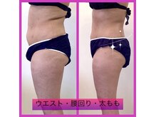 ソレイユ(Soleil)の雰囲気（1回でも変化に驚き◎短期集中コースで-5kgを叶えます！）