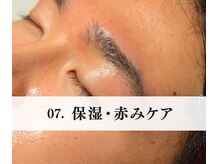 サムライビューティー 渋谷東店(SamuraiBeauty)/保湿・クーリングジェルでケア