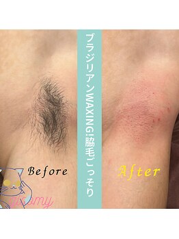 グルーミー(gloomy)/夏場快適！両脇ワックス☆