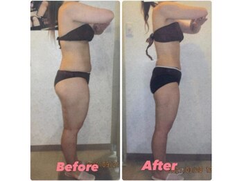 プロラボスパ 渋谷店/20代後半　痩身症例